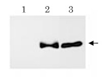 APP Delta C31 (C-terminal) in the group Antibodies Human Cell Biology / Neuroscience / Neurodegenerative diseases / Alzheimer's disease at Agrisera AB (Antibodies for research) (AS21 4571)